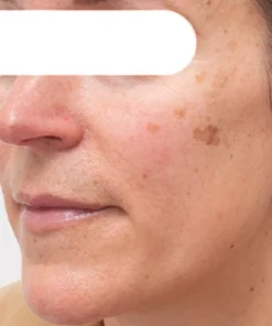 AQA™ Herbal Spots Peel-Off Facial Mask