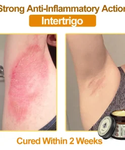 Awzlove™ Botox Bee Venom Rapid Skin Repair Cream