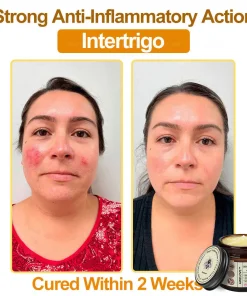 Awzlove™ Botox Bee Venom Rapid Skin Repair Cream