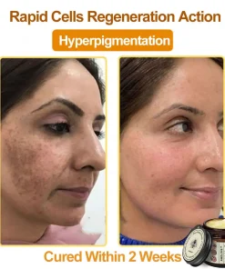 Awzlove™ Botox Bee Venom Rapid Skin Repair Cream