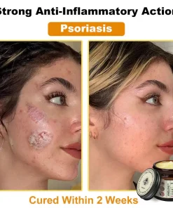 Awzlove™ Botox Bee Venom Rapid Skin Repair Cream