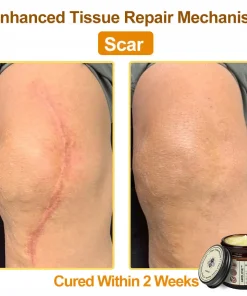 Awzlove™ Botox Bee Venom Rapid Skin Repair Cream