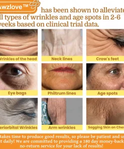 Awzlove™ Botox Bee Venom Rapid Skin Repair Cream