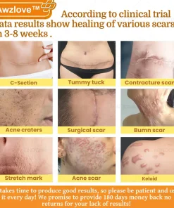 Awzlove™ Botox Bee Venom Rapid Skin Repair Cream