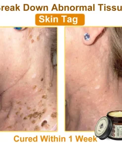 Awzlove™ Botox Bee Venom Rapid Skin Repair Cream