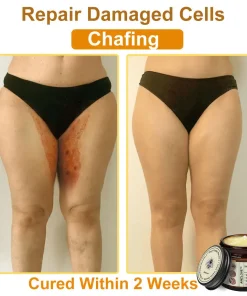 Awzlove™ Botox Bee Venom Rapid Skin Repair Cream