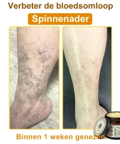 Awzlove™ Botox Bee Venom Rapid Skin Repair Cream