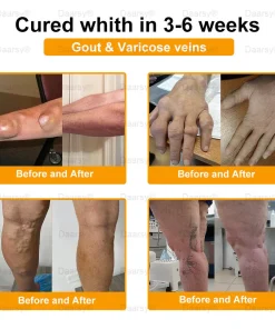 Daasry™ Botulinum Toxin & Bee Venom Pain-Relief Bone Healing Cream