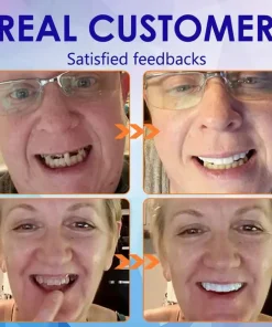 DentureGlow™ –🦷Get a Perfect Smile Fast!🦷 (⏰30-Min Flash Sale Ends Soon!⏰)