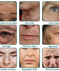 Flysmus® Botox Jellyfish Venom Peptide Nanoliposome Sculpting Anti-Wrinkle Cream