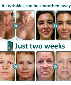 Flysmus® Botox Jellyfish Venom Peptide Nanoliposome Sculpting Anti-Wrinkle Cream