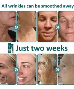 Flysmus® Botox Jellyfish Venom Peptide Nanoliposome Sculpting Anti-Wrinkle Cream