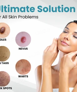 JEREMYTIS® Non-Invasive Mole and Wart Removal Laser Pen