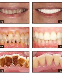 JEREMYTIS™ Ultra Whitening Mint Toothpaste