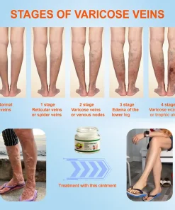 JORONDY® Horse Chestnut Vein Cream