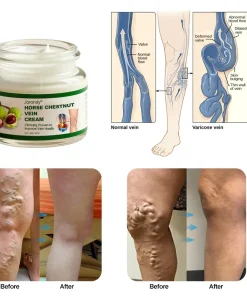 JORONDY® Horse Chestnut Vein Cream