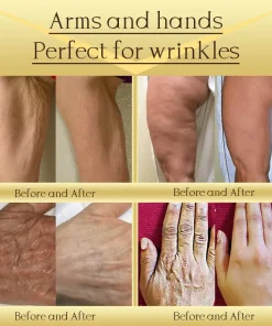 Jorondy® AH-8 Skin Firming Cream