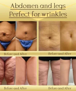 Jorondy® AH-8 Skin Firming Cream