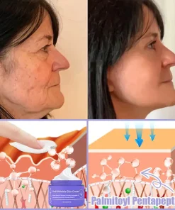 Jorondy® Anti-Wrinkle Skin Cream