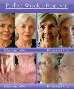 Jorondy® Anti-Wrinkle Skin Cream