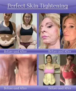 Jorondy® Anti-Wrinkle Skin Cream