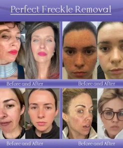 Jorondy® Anti-Wrinkle Skin Cream