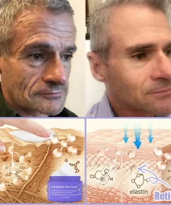 Jorondy® Anti-Wrinkle Skin Cream