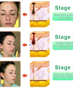 Jorondy® Purifying Exfoliating Gel