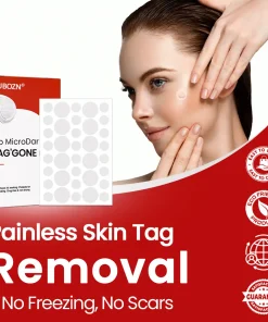 KUBOZN® Pro MicroDarts TAG'Gone Patch