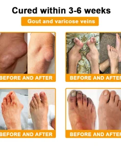 LOTMAY® Bee Venom Pain-Relief Bone Healing Cream