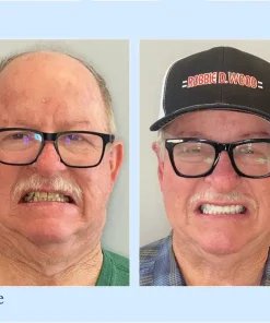 Neslemy™ - Premium Denture