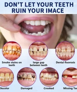 Neslemy™ - Premium Denture