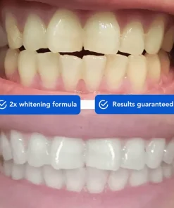 OneiasSmile™ Dissolvable Teeth Whitening Strips