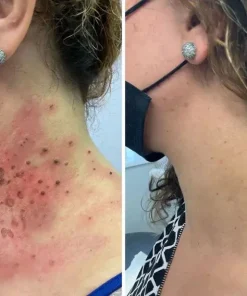 STDEI® APIS VENENUMREPAIR BALM