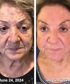 STDEI® APIS VENENUMREPAIR BALM