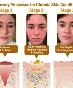 STDEI® APIS VENENUMREPAIR BALM