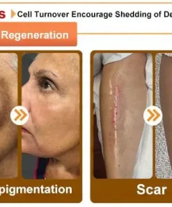 STDEI® APIS VENENUMREPAIR BALM