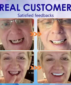 SmileFitPro™-New Generation Flexible Full Denture Solution