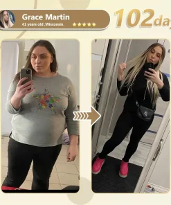 TOD𝐀𝖧OF®🏆 TZP-G𝖫P1 𝐍𝐚𝐧𝐨 𝐌𝐢𝐜𝐫𝒐𝐧𝐞𝐞𝐝𝐥𝐞 𝐒𝐥𝐢𝐦𝐦𝗶𝐧𝐠 𝐏𝐚𝒕𝐜𝐡