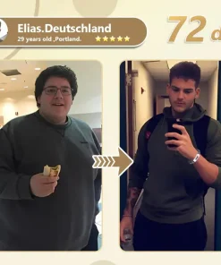 TOD𝐀𝖧OF®🏆 TZP-G𝖫P1 𝐍𝐚𝐧𝐨 𝐌𝐢𝐜𝐫𝒐𝐧𝐞𝐞𝐝𝐥𝐞 𝐒𝐥𝐢𝐦𝐦𝗶𝐧𝐠 𝐏𝐚𝒕𝐜𝐡