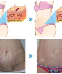 Tnnedey® NAD+ Nasal Spray