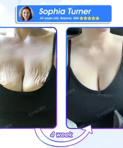 Tnnedey® NAD+ Nasal Spray