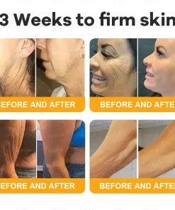 VLSVLS® Bee Venom Skin Restoration Cream