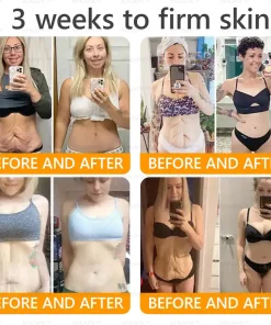 APKAPK® Bee venom Comprehensive Cream