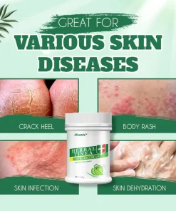 Alisanda™ Herbal Tinealess Cream