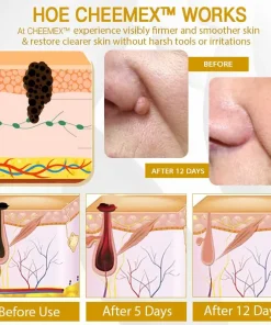 Cheemex™ CastorBee Tag & Spots Peel-Off Mask