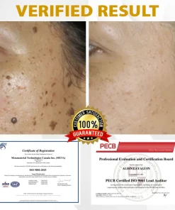 Cheemex™ CastorBee Tag & Spots Peel-Off Mask