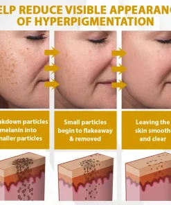 Cheemex™ CastorBee Tag & Spots Peel-Off Mask