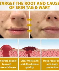 Cheemex™ CastorBee Tag & Spots Peel-Off Mask