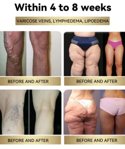 Croaie® NIDDK Tirzepatide Cyclic Peptide Thermo Slim Cream